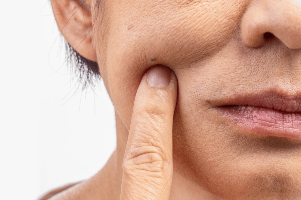 Dull or stressed skin texture Dull or stressed skin texture